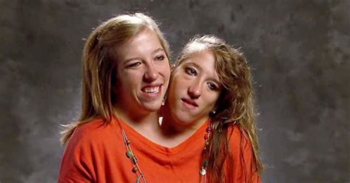 Abby and Brittany Hensel: The Extraordinary Lives and Legacy of Conjoined Twins