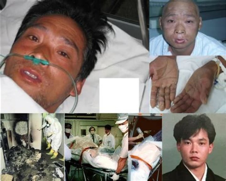 Captivating Hisashi Ouchi Pictures: A Glimpse into the Life of the Radiation Accident Survivor