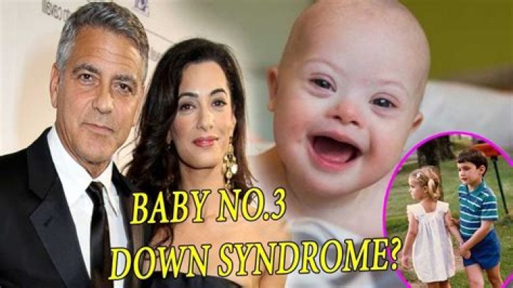 Does Simon Cowell's Son Have Down Syndrome? Unraveling the Truth Behind the Rumors