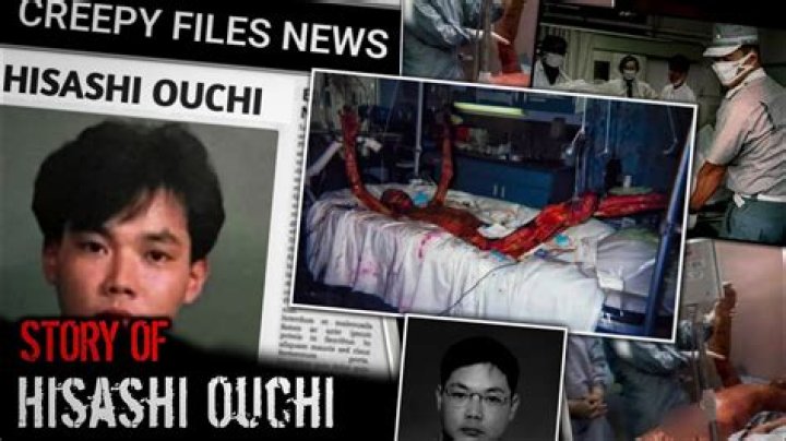 Hisashi Ouchi: The Untold Story Behind the Real Photos and Tragic Incident