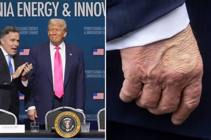 Is Donald Trump Left or Right Handed? Uncovering the Facts