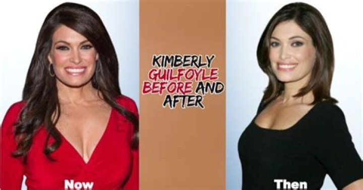 Kimberly Guilfoyle Before Plastic Surgery: A Deep Dive into Her Transformation