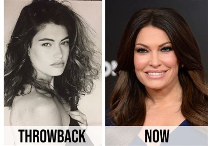 Kimberly Guilfoyle Surgery: A Comprehensive Guide to Her Transformative Journey