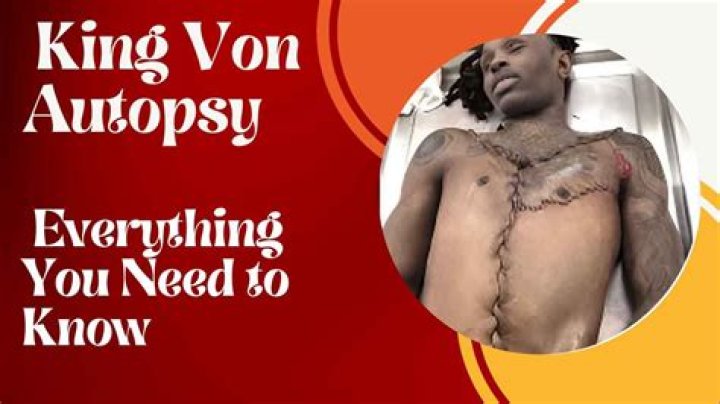 King Von Autopsy: A Deep Dive into the Life, Death, and Legacy of the Late Rapper