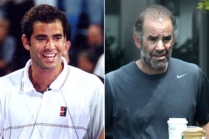 Pete Sampras Today: A Look at the Legendary Tennis Player's Life and Legacy