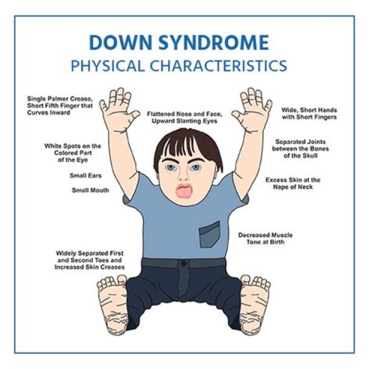 Simon Cowell's Son with Down Syndrome: A Heartwarming Journey