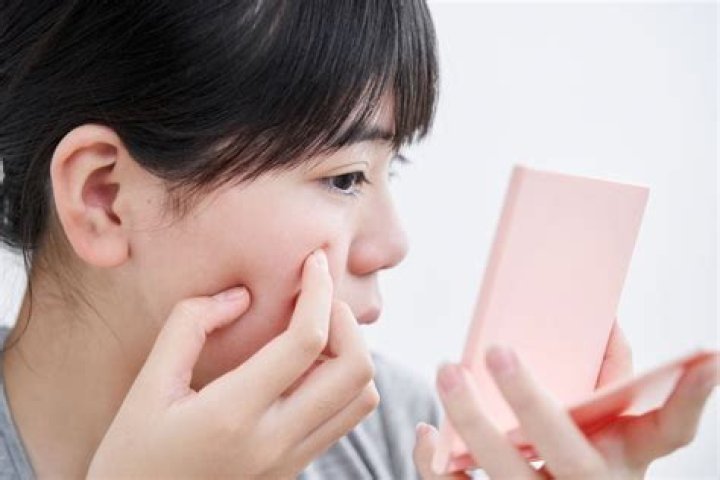 Unlocking The Secrets Of Scar Reduction